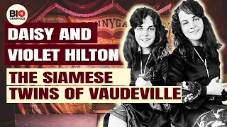 Daisy and Violet Hilton: The Siamese Twins of Vaudeville