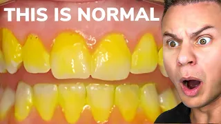 Yellow Teeth Aren’t As Bad As You Think