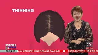 Totoo bang nakakakalbo ang parating pagsusuot ng sumbrero?