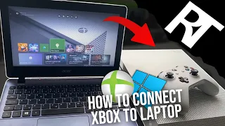 How to connect Xbox to laptop (2024) How to connect Xbox to a computer