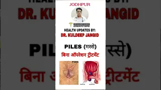 Piles treatment without operation #short । मस्से का बिना ऑपरेशन इलाज ।