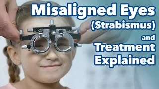 Misaligned Eyes (Strabismus) and Treatment Explained. What is Strabismus?