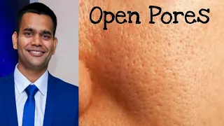 How To Get Rid Of Open Pores Permanently | open pores on face Treatment