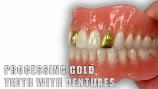 Processing Gold Teeth with Dentures