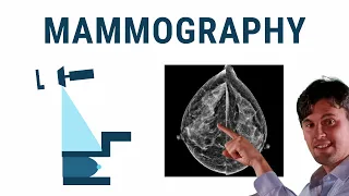 Mammography (X-ray Physics)