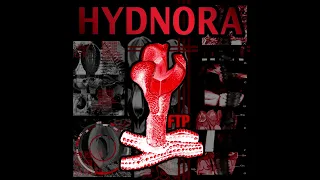 Free toilet paper - HYDNORA