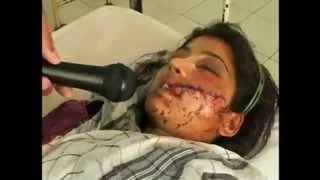 Pakistani-Punjabi Woman Survives Attempted Honor Killing