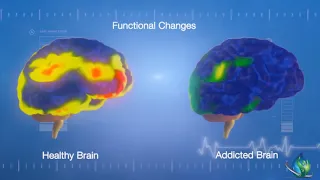 Neurobiology of Addiction