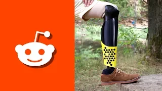 I 3D Printed a Leg for a Redditor