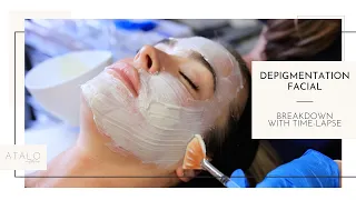 Depigmentation Facial Treatment I Skin Brightening