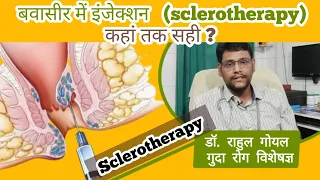 #PILES - 1 Sclerotherapy बवासीर में इंजेक्शन लगवाना कहां तक सही | Goyal Piles Hospital 8950718983