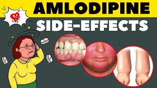Amlodipine Side Effects & How to Avoid || Amlodipine Adverse Effects