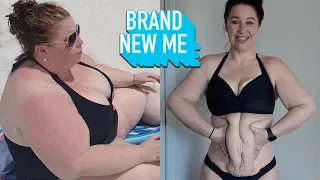 I Lost 230lbs But Can Surgery Fix My Excess Skin? | BRAND NEW ME