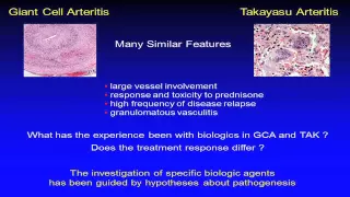 Biologics and Vasculitis