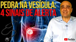 4 sinais e sintomas de alerta para pedra na vesícula