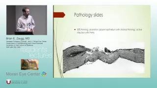 Corneal Infectious Diseases Part I