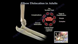 Elbow Dislocation In Adults - Everything You Need To Know - Dr. Nabil Ebraheim