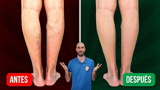 5 Ejercicios para MEJORAR la CIRCULACION de las piernas DE PIE EN EL TRABAJO