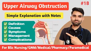 Upper Airway Obstruction Lecture in Hindi | Upper Airway Obstruction in Pediatrics