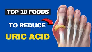 10 Best Foods to Lower Uric Acid Levels | Uric Acid | Gout diet