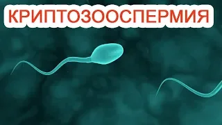 Криптозооспермия / Доктор Черепанов