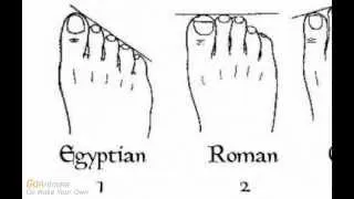 Ancestry, Genealogy, and Shape of Your Toes (Based on this what are your roots?)