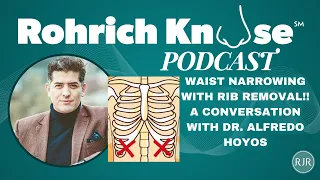 Waist Narrowing with Rib Removal!! A Conversation with Dr. Alfredo Hoyos