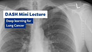 DASH Mini Lecture: Deep Learning for Lung Cancer