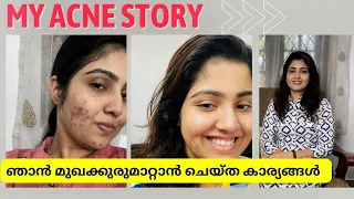 My Acne story/ഞാൻ മുഖക്കുരുമാറ്റാൻ ചെയ്ത കാര്യങ്ങൾ/Chemical peel experience/My current skin care