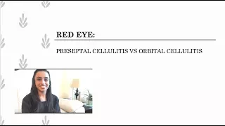 PRESEPTAL CELLULITIS VS ORBITAL CELLULITIS