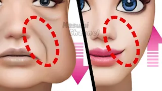 ANTI-AGING FACE LIFTING EXERCISES For Laugh Lines, Sagging Cheeks (Nasolabial Folds/ Smile Line)