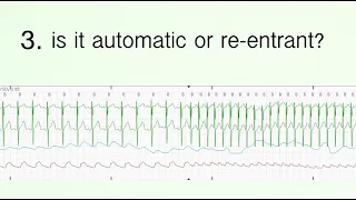 CICU rhythms: automatic vs reentrant tachycardias