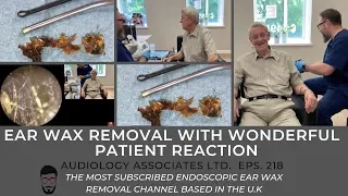 EAR WAX REMOVAL AND WONDERFUL PATIENT REACTION - EP 218