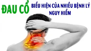 Bệnh Đau Cổ Biểu Hiện Của Nhiều Bệnh Lý Nguy Hiểm