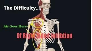 The Massive Amounts of Right Thoracic Musculature That Needs Inhibiting