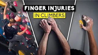 Finger Injuries in Climbers | Lattice Training X Sheffield Climbing Clinic - Part 1