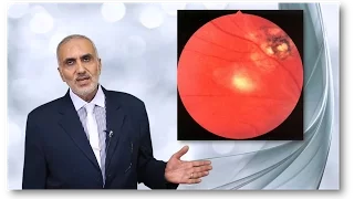 Elbromboly Basic ophthalmology IC Uvea Choroditis