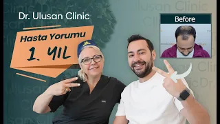 Hastamızın Saç Ekimi Sonrası 1. Yılında Dr. Sibel Ulusan ile Röportajı 🤩