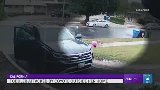 2-year-old girl recovering after coyote attack outside a California home