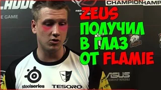 ЗЕВС ПОЛУЧИЛ В ГЛАЗ ОТ FLAMIE!