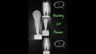 Maxillary first premolar || Right || Carving