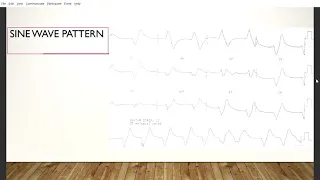 ECG in non cardiac conditions - Dr Sreekanth B Shetty