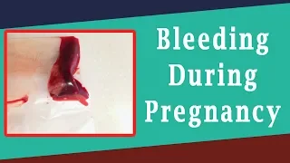 Bleeding During Pregnancy | Common Reasons