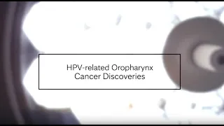 HPV-related Oropharynx Cancer Discoveries - Mayo Clinic