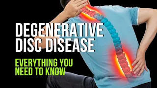 Degenerative Disc Disease - Everything You Need to Know