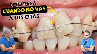 Nunca dejes de ir a tus citas dentales 😱