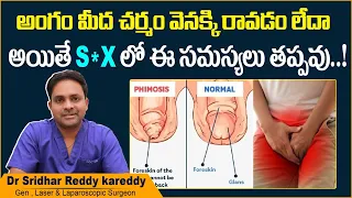 చర్మం వెనక్కి రాకపోతే | Best Treatment for Foreskin Problems | Phimosis | Treatment Range Hospital