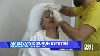 Ameliyatsız Burun Estetiği