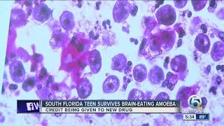 South Florida teen survives brain-eating amoeba