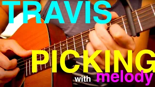 Adding Melody to Travis Picking Fingerpicking Guitar Lesson.